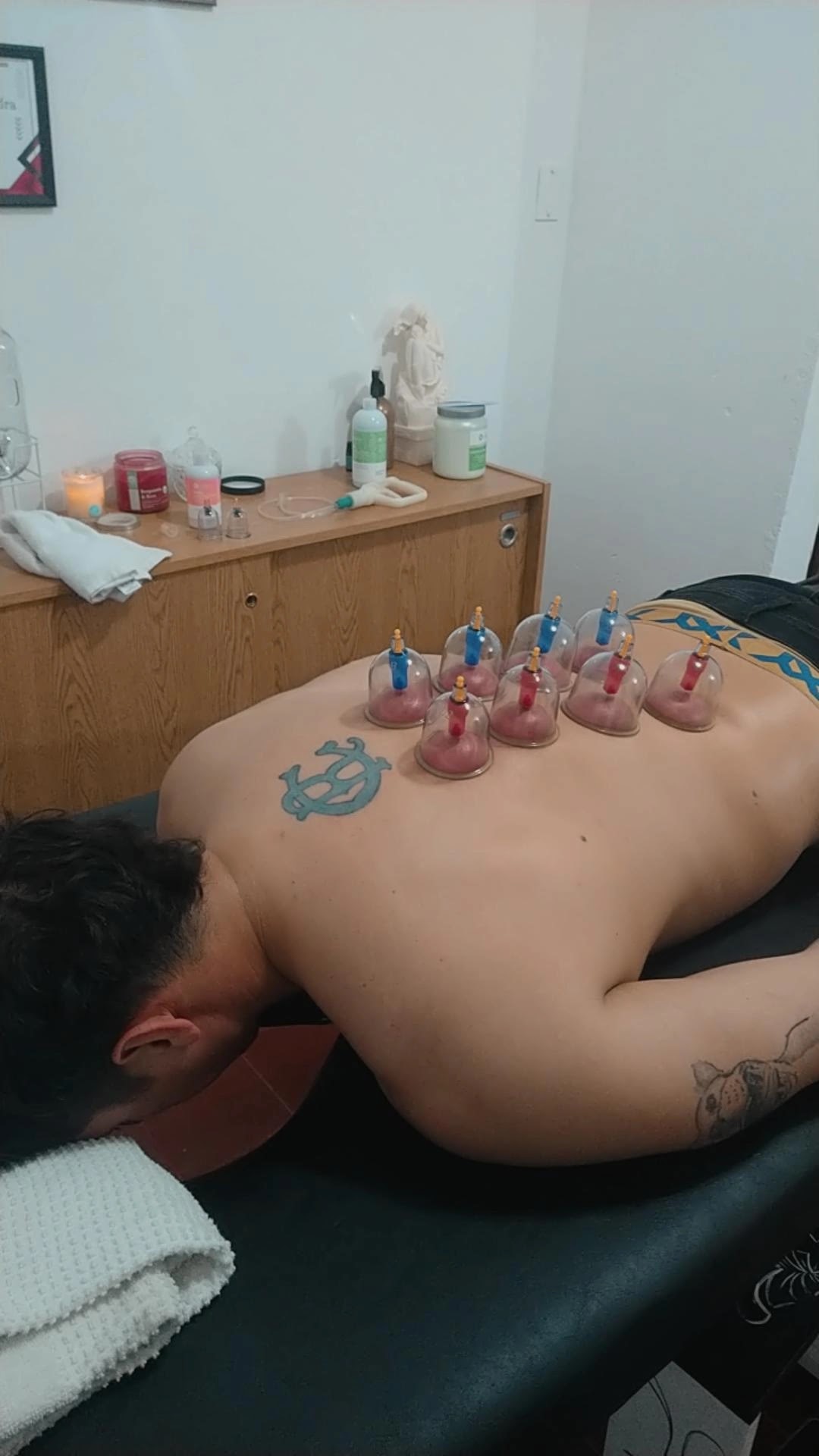 Ventosaterapia terapéutica con copas de succión profesional